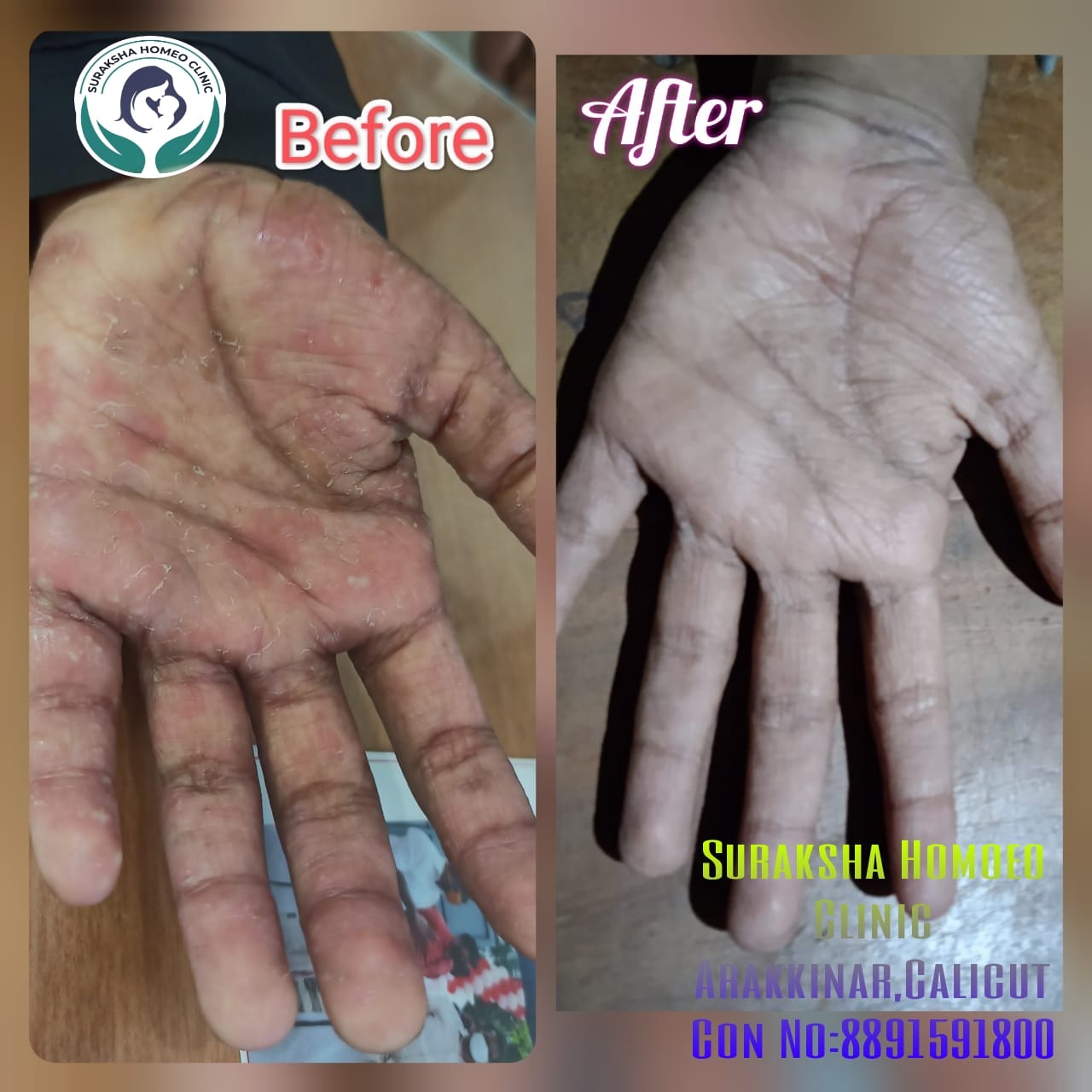 Suraksha Homoeopathic Clinic Arakkinar